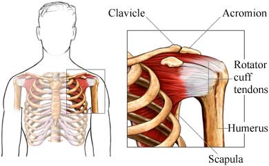 biceps tendinitis gyógyulási ideje)